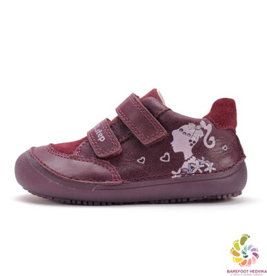 D.D. Step Raspberry S063-52937A