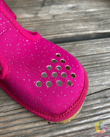 Beda papuče Pink Shine (perforované)