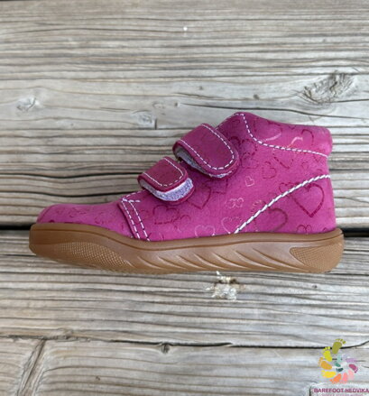 Boots4u T025 Velcro Ružová potlač