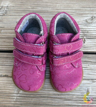 Boots4u T025 Velcro Ružová potlač