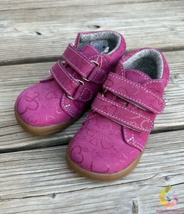 Boots4u T025 Velcro Ružová potlač