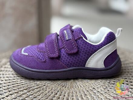 Protetika Alex Purple